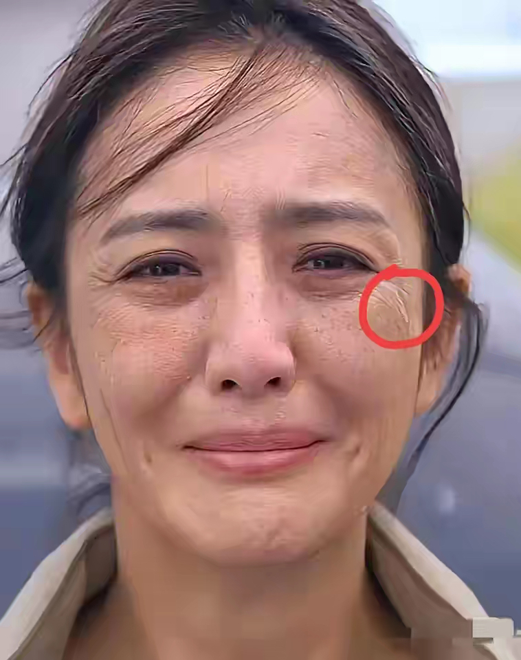 一脸雀斑像一个中年妇女,眼角的鱼尾纹特别明显,这样的女人扔在人群里