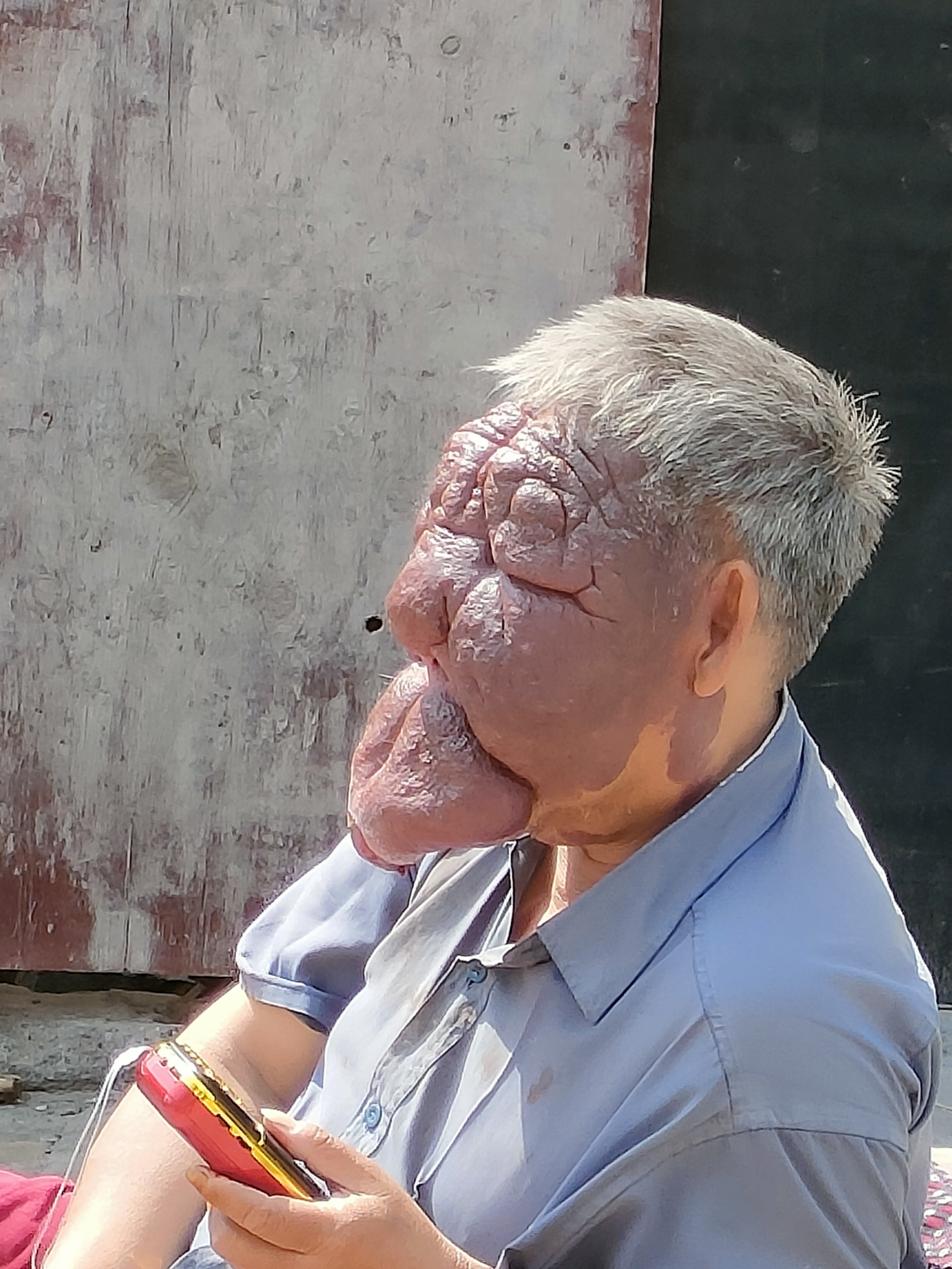 这是什么病,可有治疗的地方