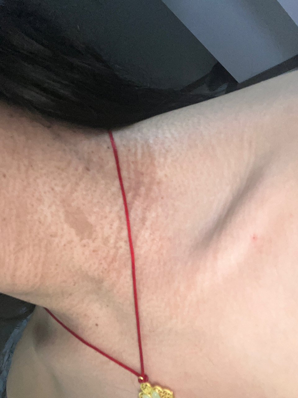 这种脖子怎么跟除啊.