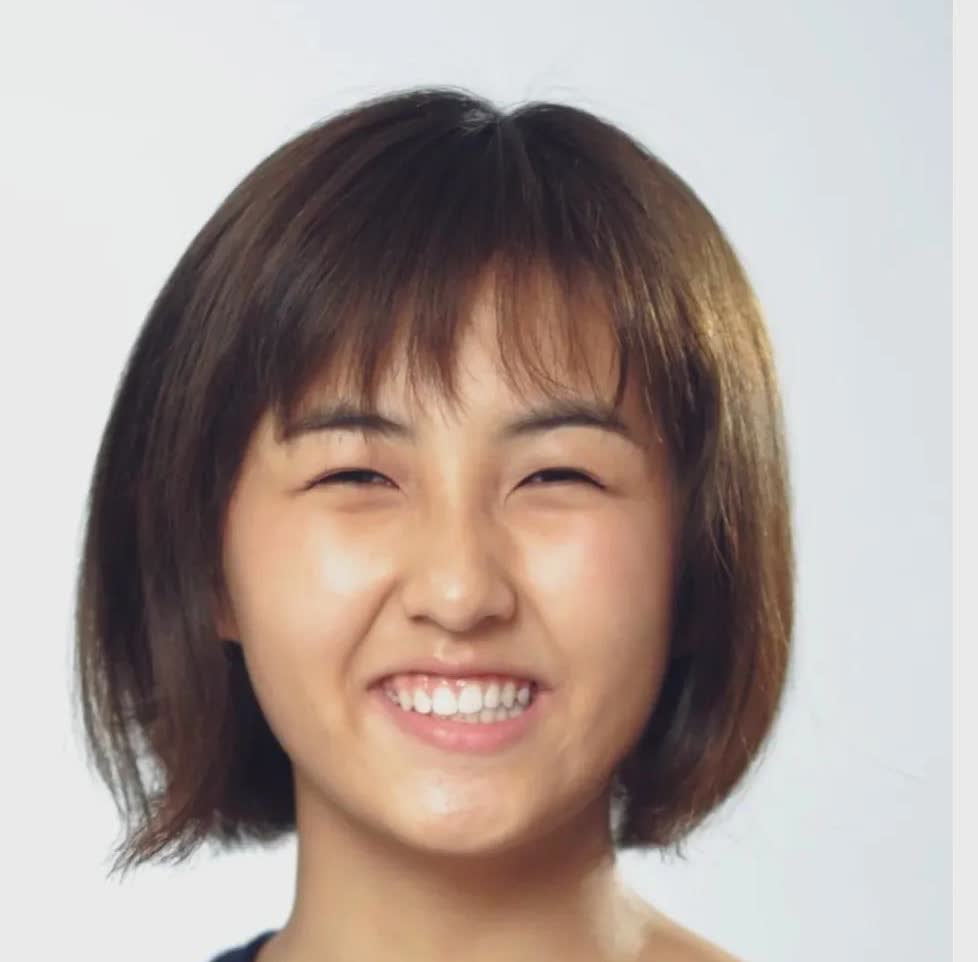 热点观察家#张子枫早期生图还是个小胖子,脸上肉嘟嘟的,皮肤黝黑发亮