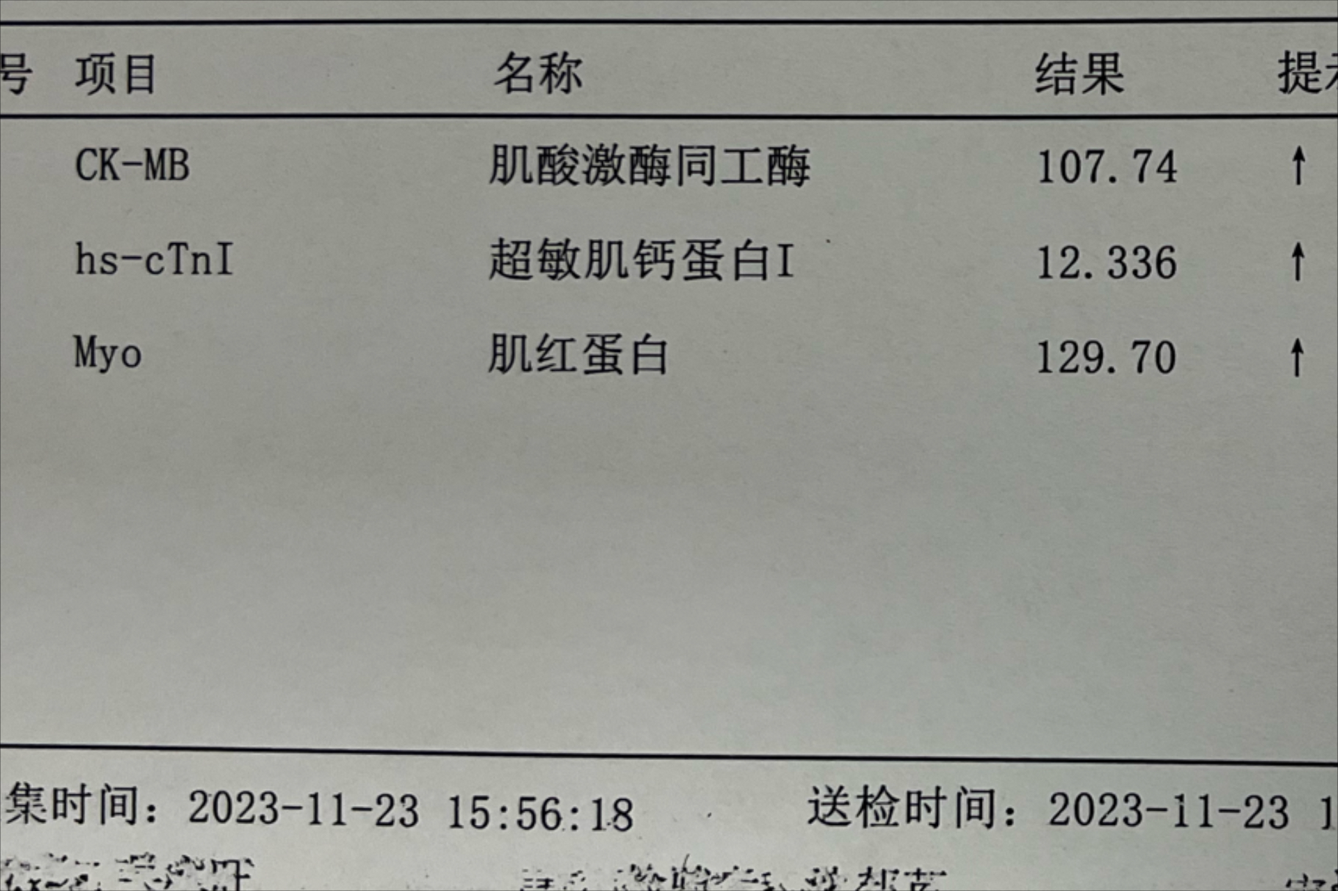 急性心肌梗死分为急性st段抬高型心肌梗死和急性非st段抬高型心肌梗死