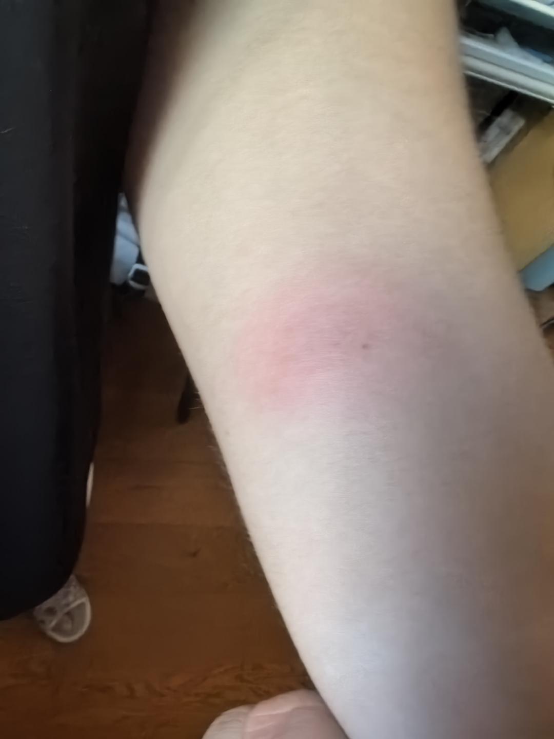 这种ppd第二天正常吗