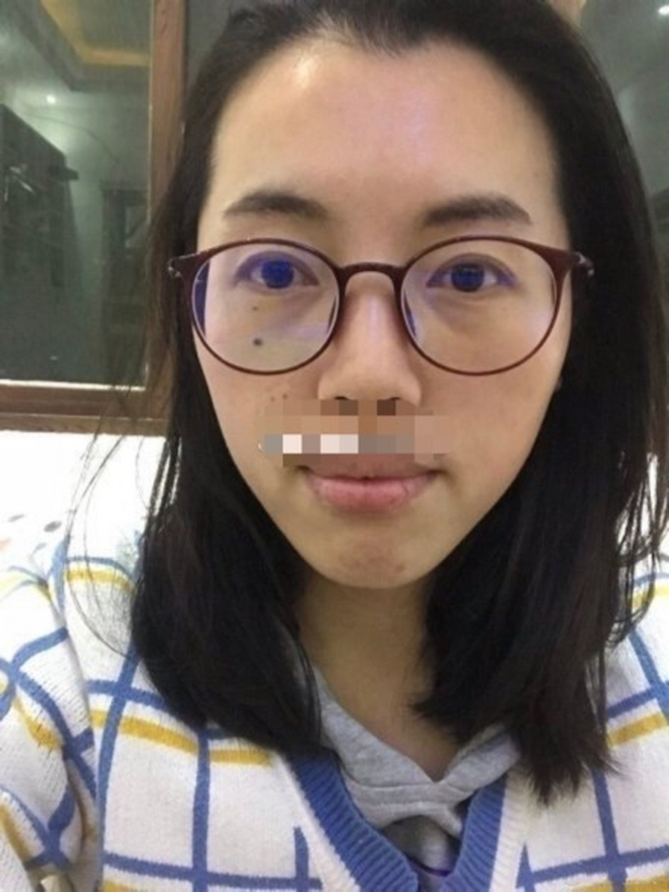 面相预测#从面相中看,眼下连着长了两颗哭夫痣,一颗小的,一颗大的,m