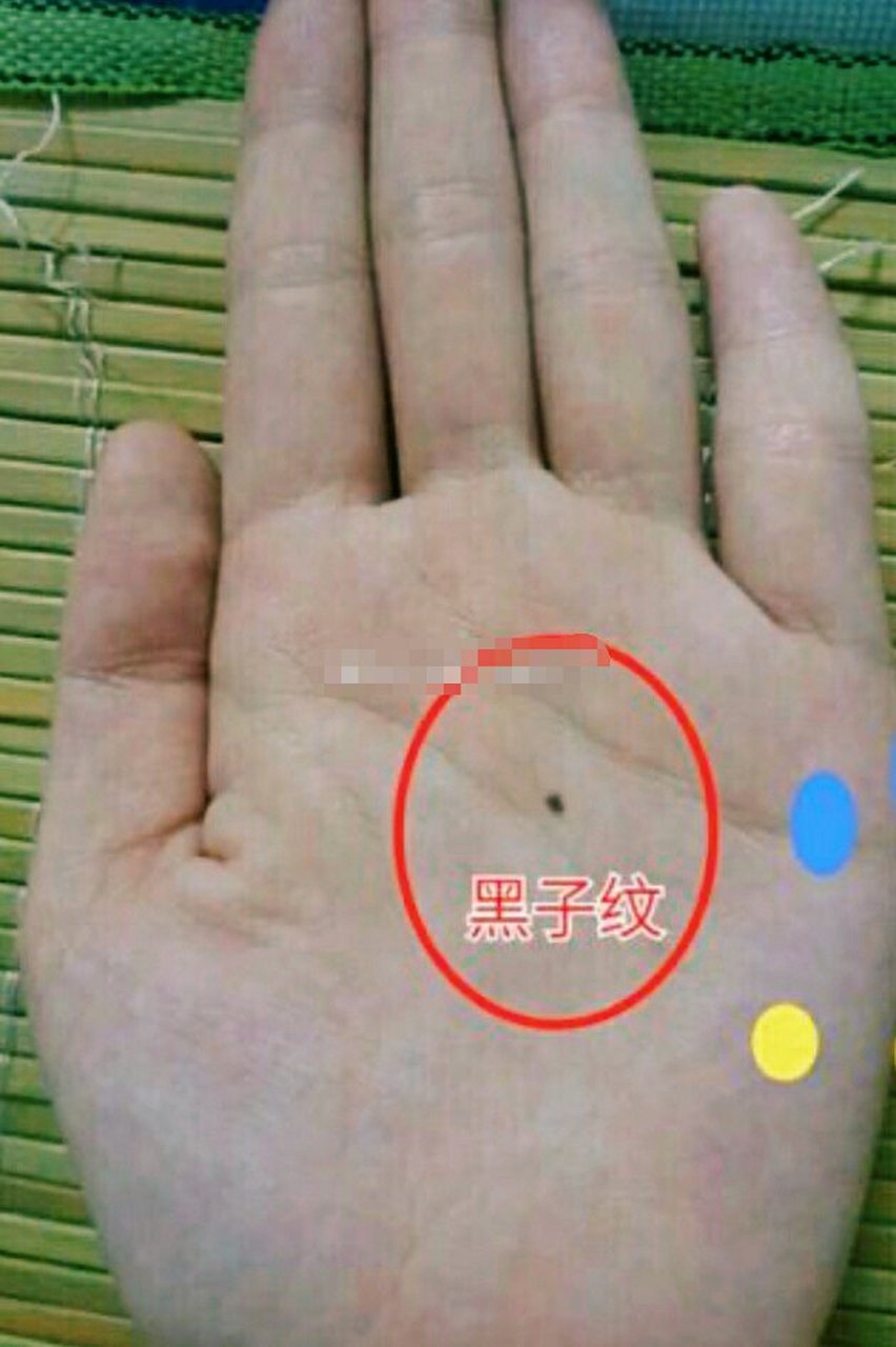 手相黑子纹,其实就是平痣的一种,在相术中也当"财