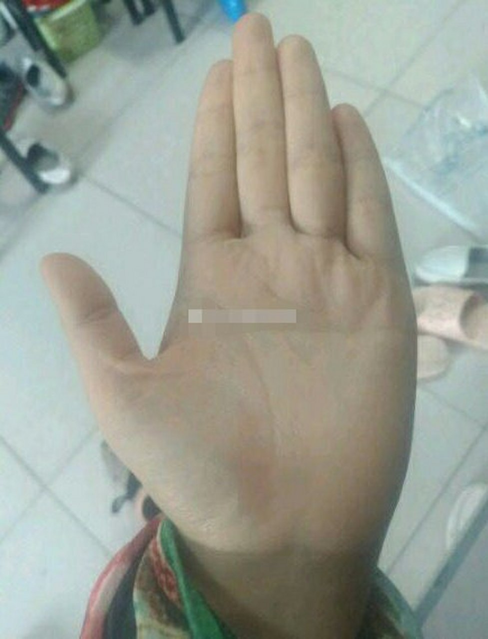 从手掌中看,双手的掌纹和别人不一样,是断掌手纹,又叫通贯掌.