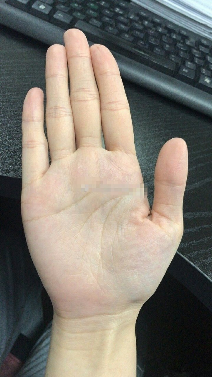 从手相来看,手有棺材纹,预示着你的健康问题有大隐患!