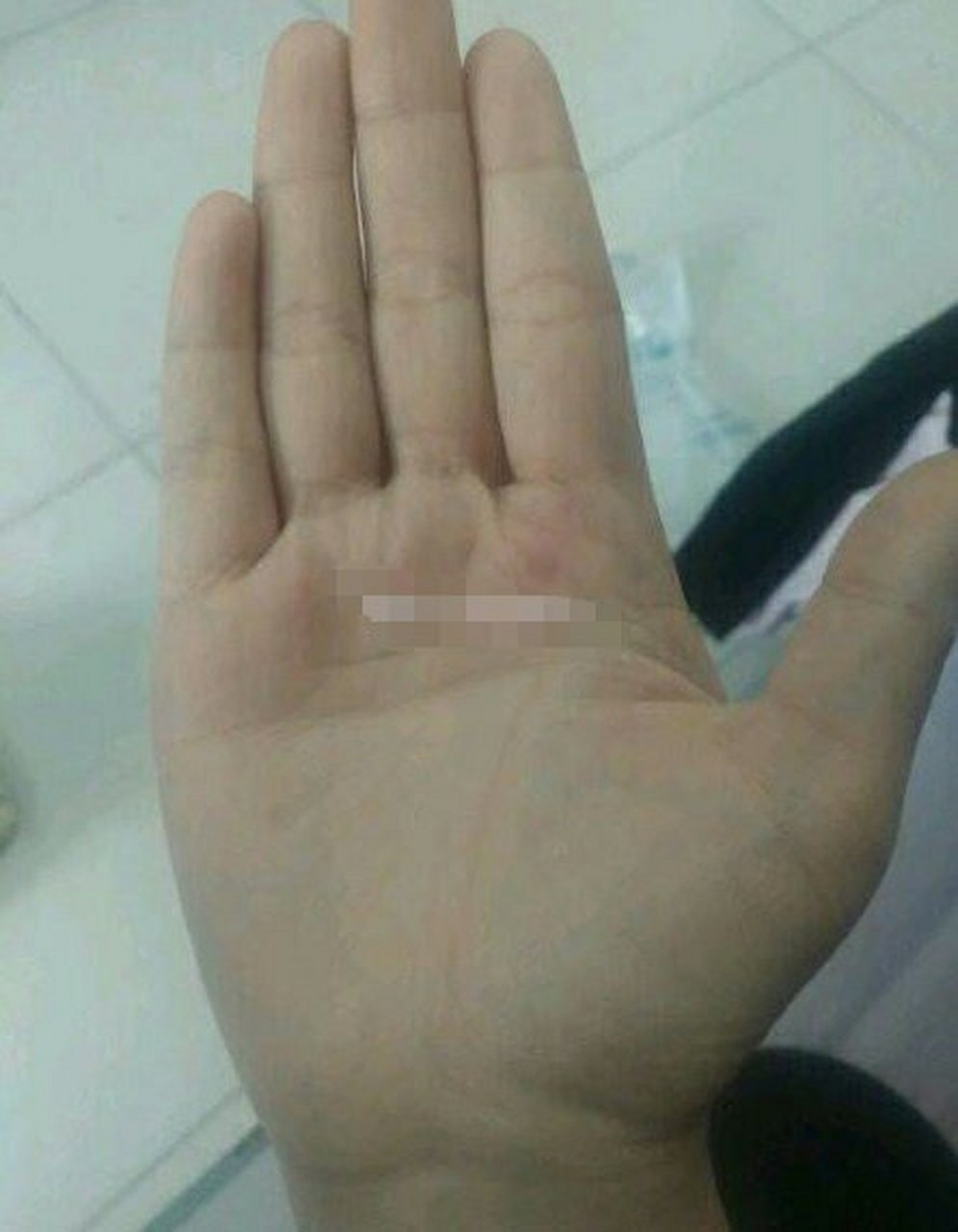 从手掌中看,双手的掌纹和别人不一样,是断掌手纹,又叫通贯掌.