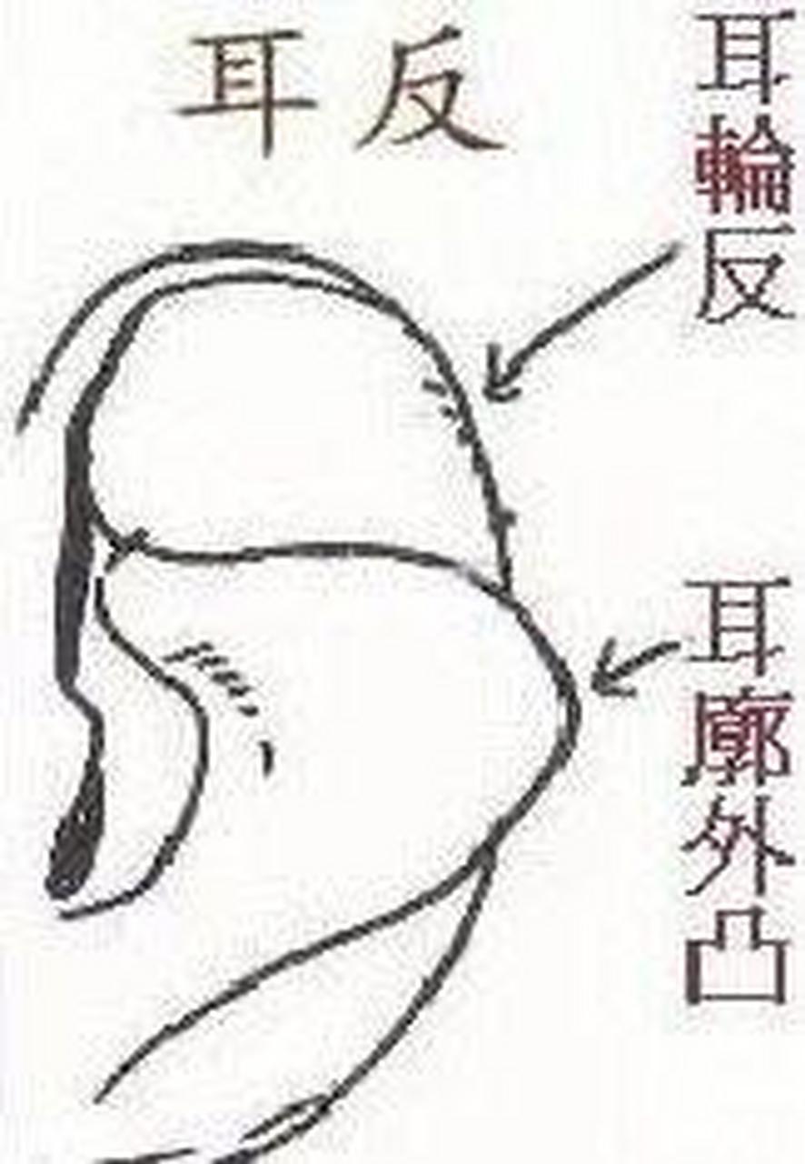 反廓耳的面相有着怎样的性格运势呢?