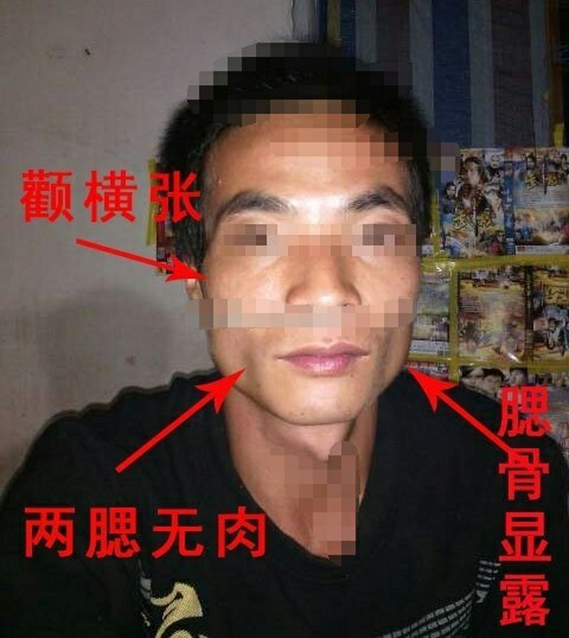1,两腮无肉 两腮无肉就是腮骨如刀削般的倒三角脸,由于缺乏责任心