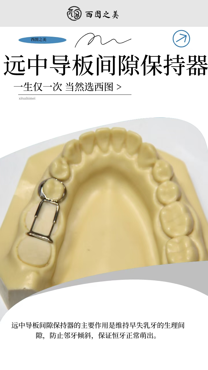——远中导板间隙保持器适应证: 1