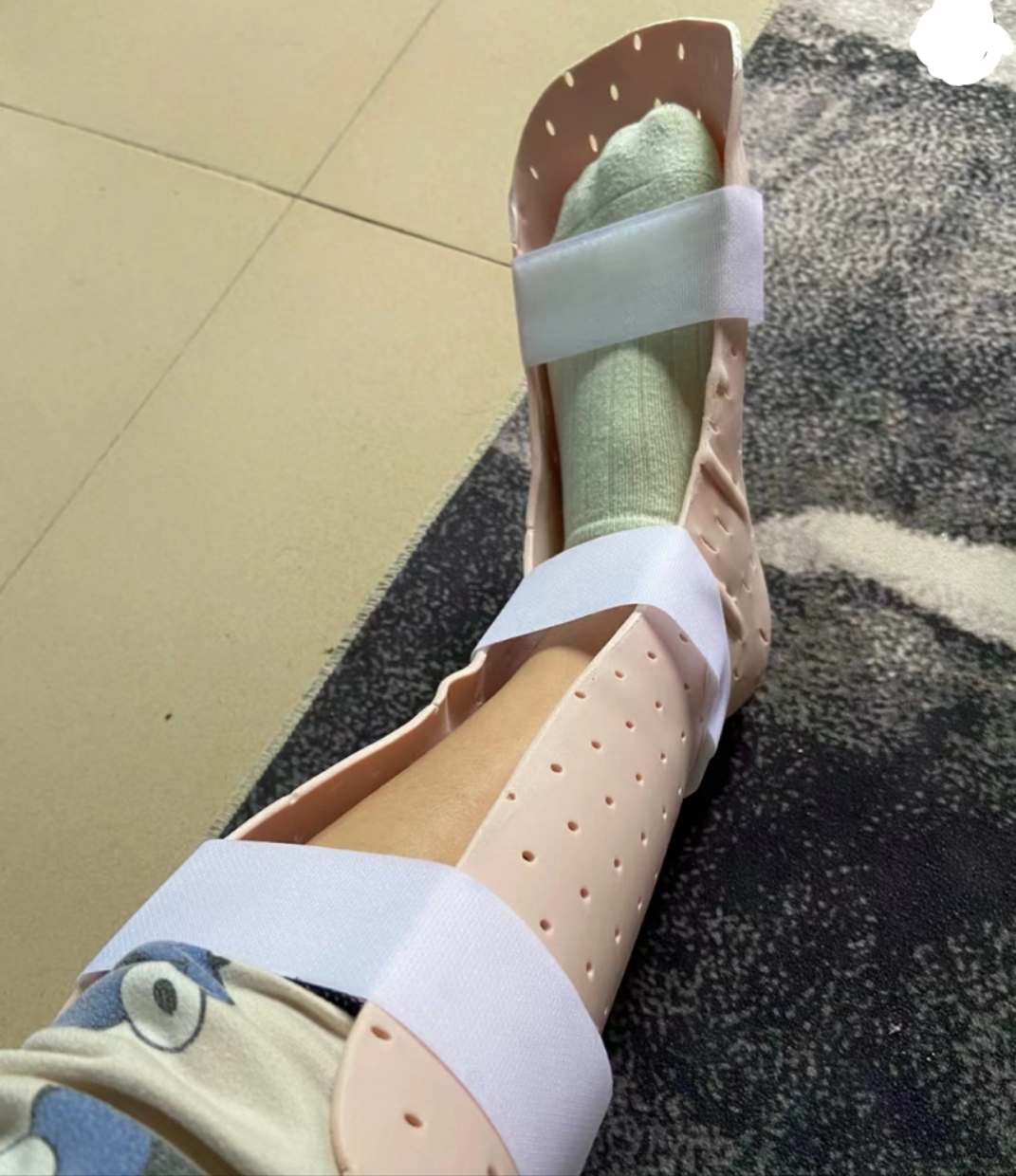 腿受伤绷带包扎图片脚扭伤图片真实图片请假专用腿包纱布照片腿包扎