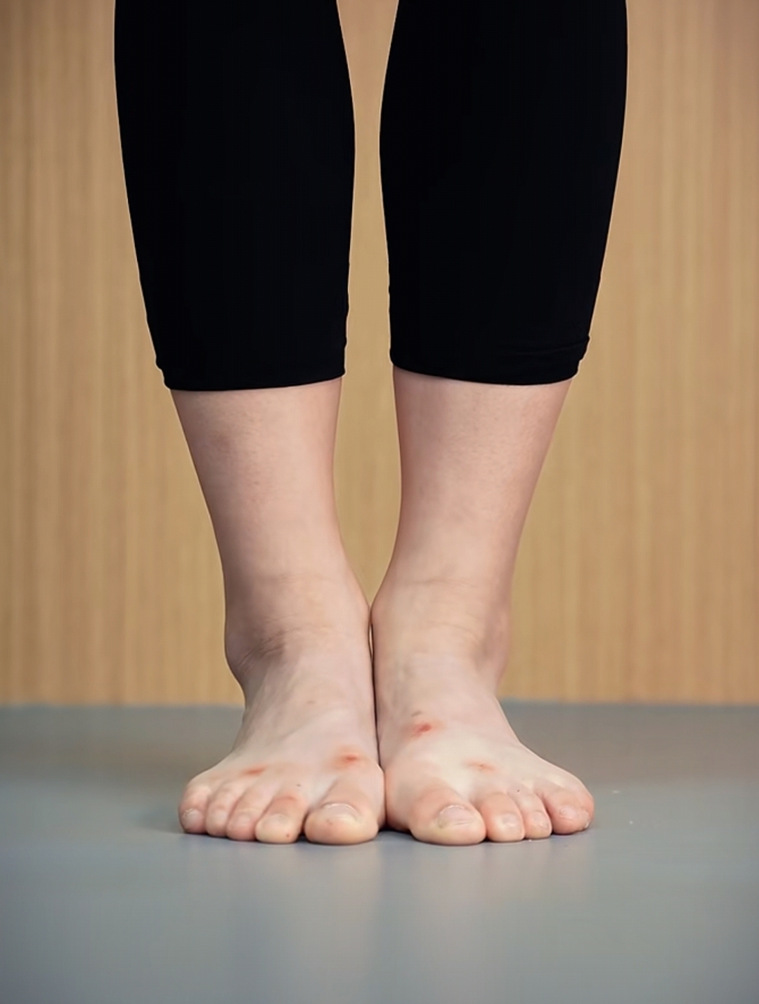 脚趾变形舞蹈女生脚丫突出左脚的舞蹈动作舞蹈生的脚图片芭蕾舞者的脚