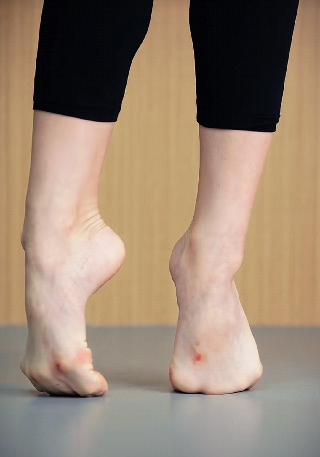 臭脚舞蹈生脚趾舞蹈演员的双脚跳舞的跳芭蕾舞的脚趾头的图片舞蹈生