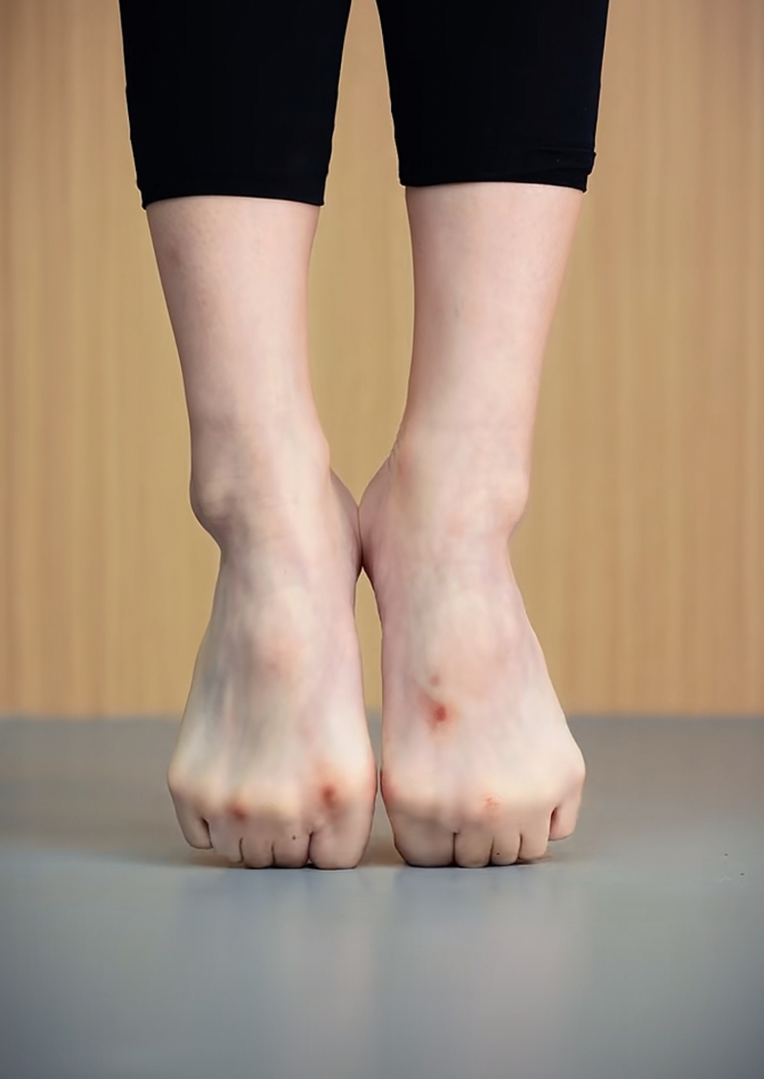 舞者怎样压脚趾舞蹈女孩红肿脚掌图片练芭蕾舞的脚芭蕾优美舞蹈生脚趾