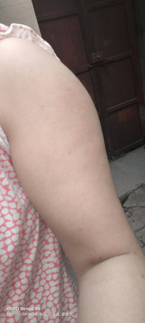 打完安徽智飞育苗第三针就成这样了,有谁知道这是咋回事