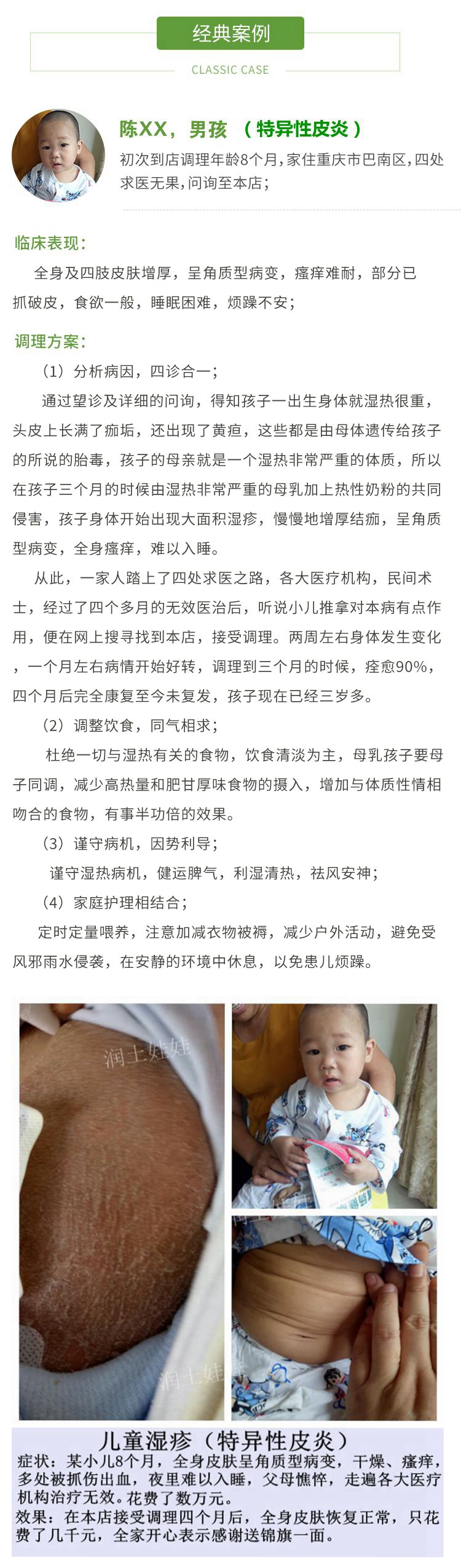 兒童特異性皮炎經典案例 兒童特異性皮炎就是中醫裡面的乾性溼疹,主要