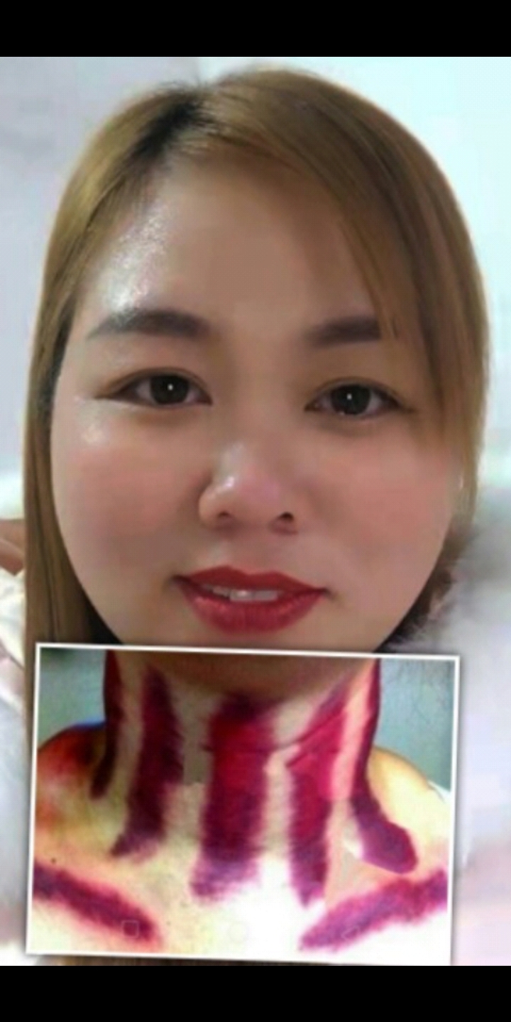 性感揪痧美女图片