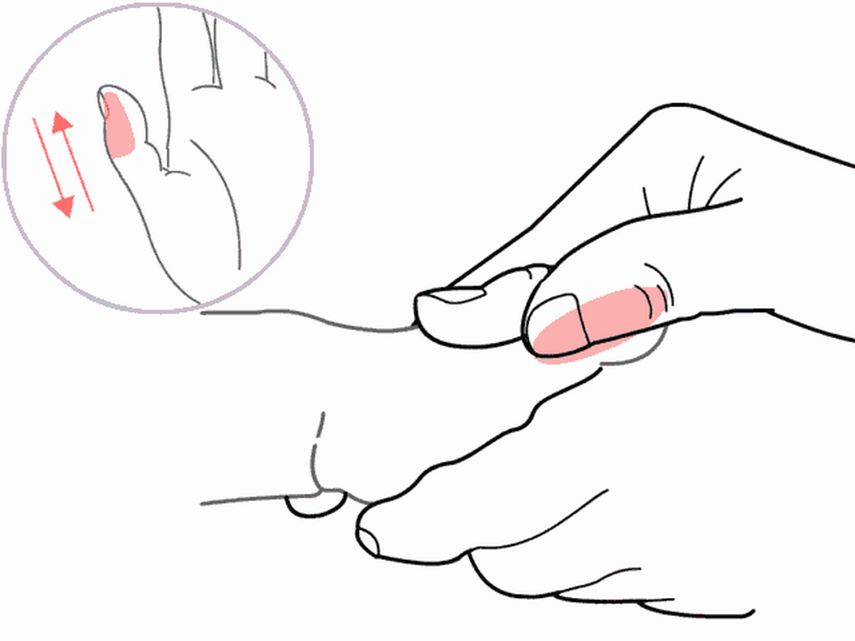 清补脾(5分钟500次) 位置:拇指外侧缘. 作用:健脾和胃,消积导滞.  2.