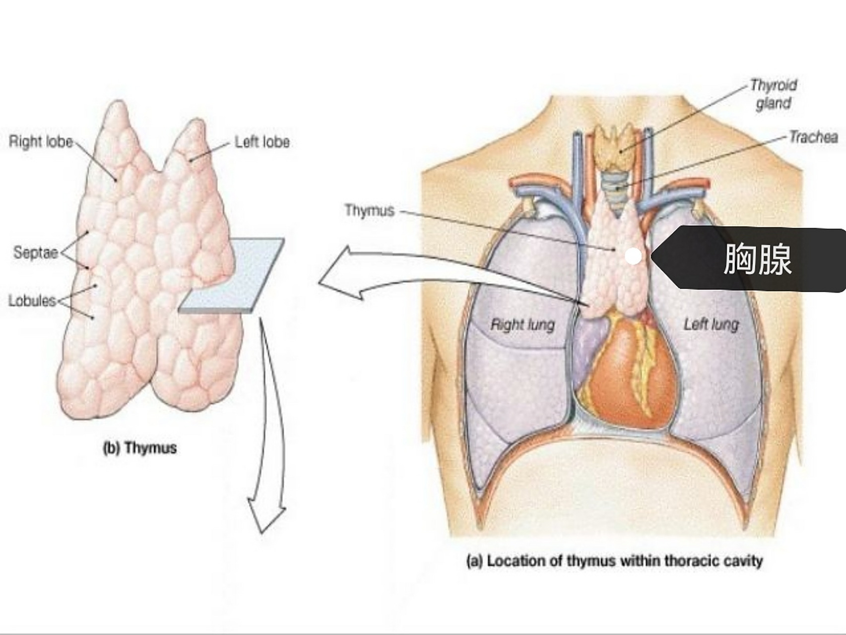 胸腺是乳房的专业名词吗?乳腺指乳房,是乳房的专业叫法.