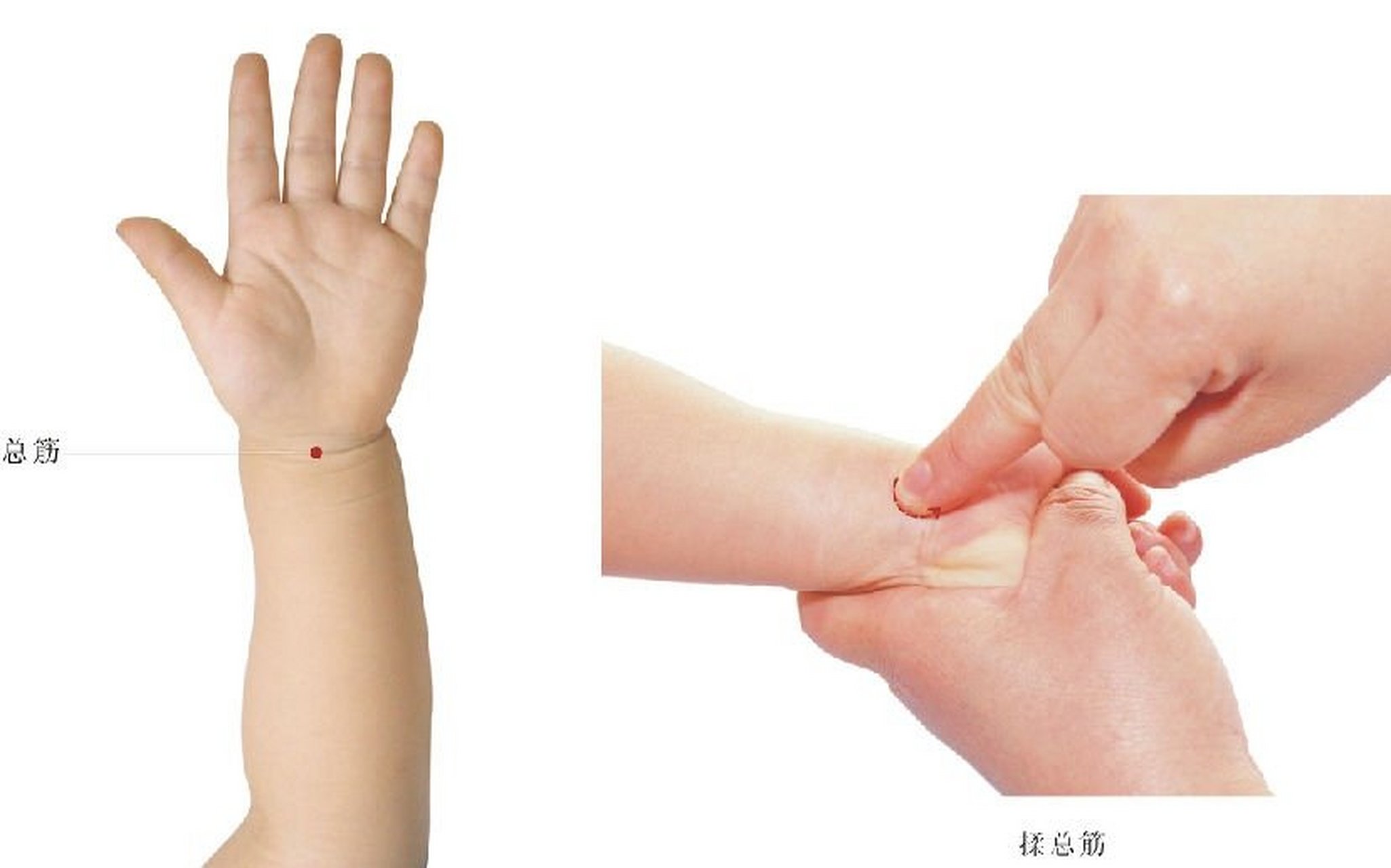 操作:术者左手托小儿手,使其掌心向上,右手中指揉之,称揉总筋;或用