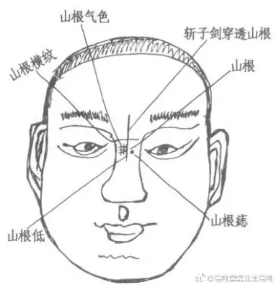 02枕骨强起 高起