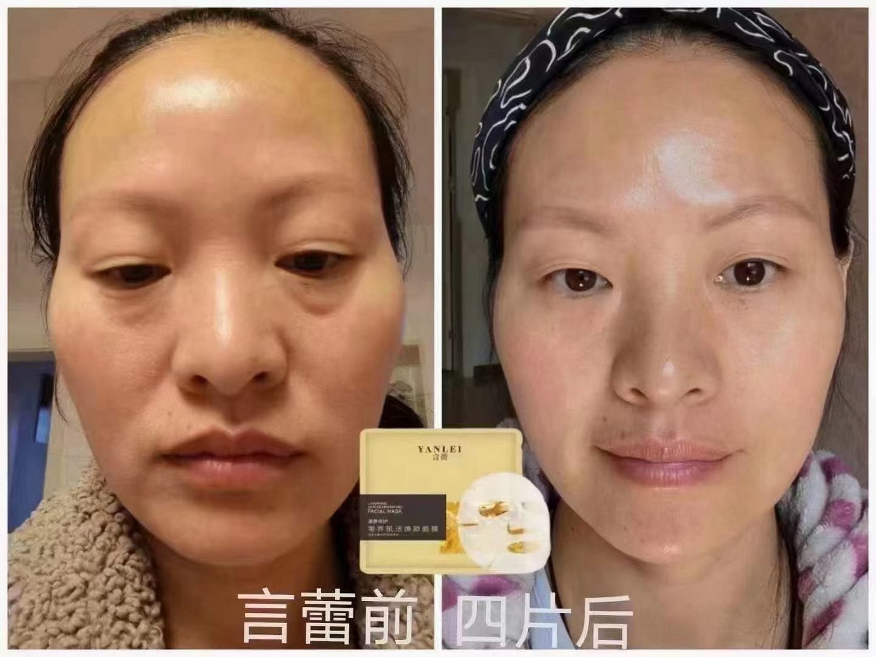 言蕾回春面具  让你的脸部肌肤一点一点饱满起来#回春面具