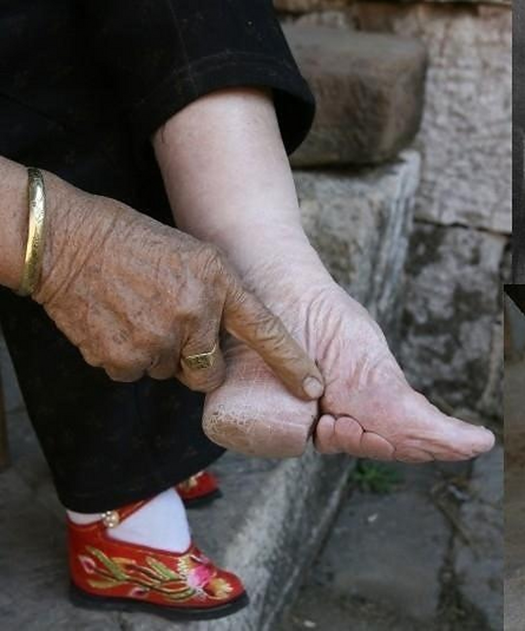 封建时期的三寸金莲对幼儿好残忍,好好的一双脚被裹得只剩两根大脚趾.