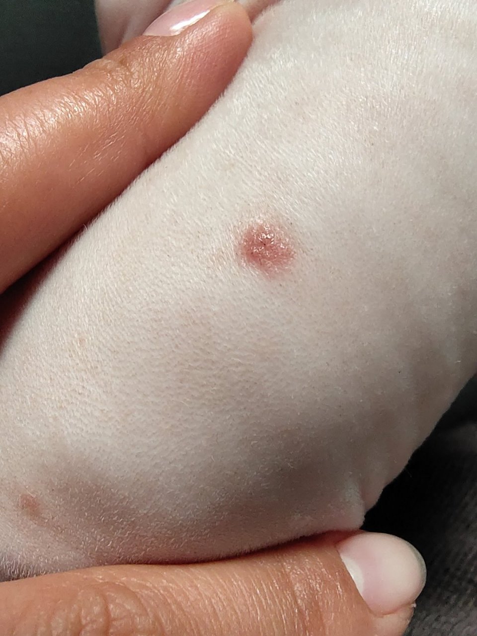 无毛猫身上是猫癣吗?没有起皮,求助啊