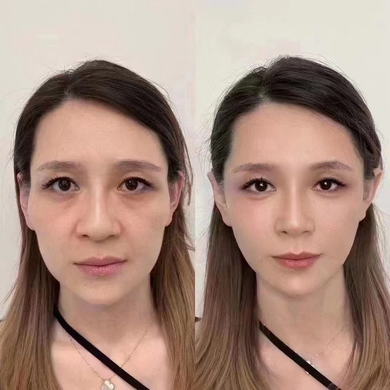 希洛缇打开大门欢迎93你来学习