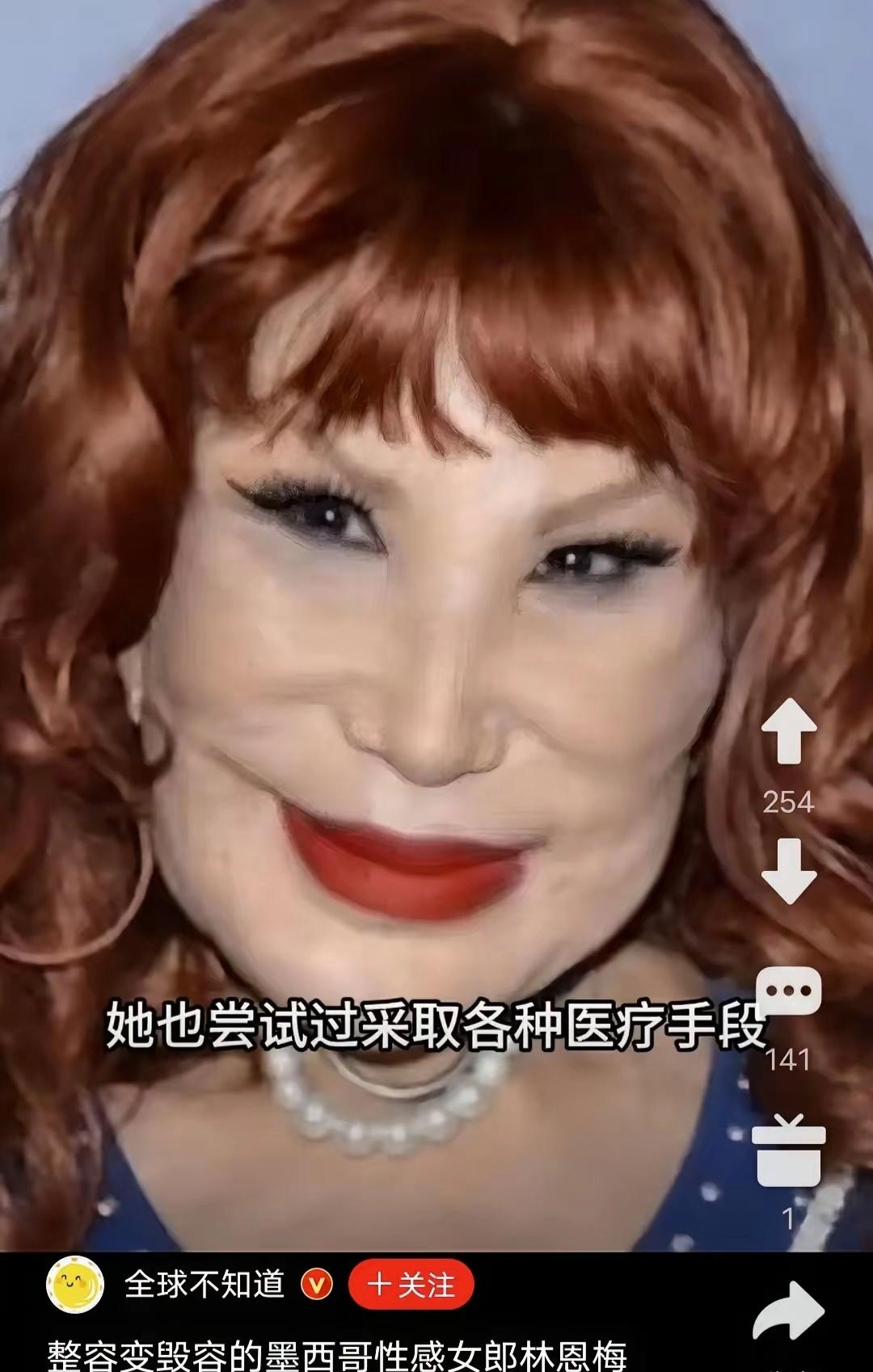 盘点那些整容失败的明星.希望带给你的不是惊吓.