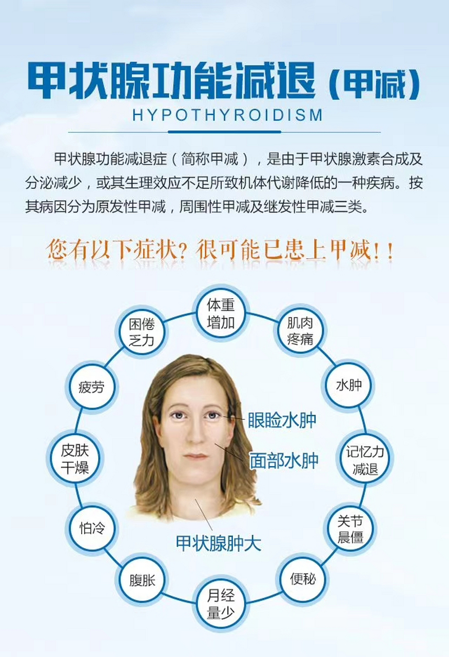 甲减自测小常识 如果你有以下症状 很可能已患上甲减