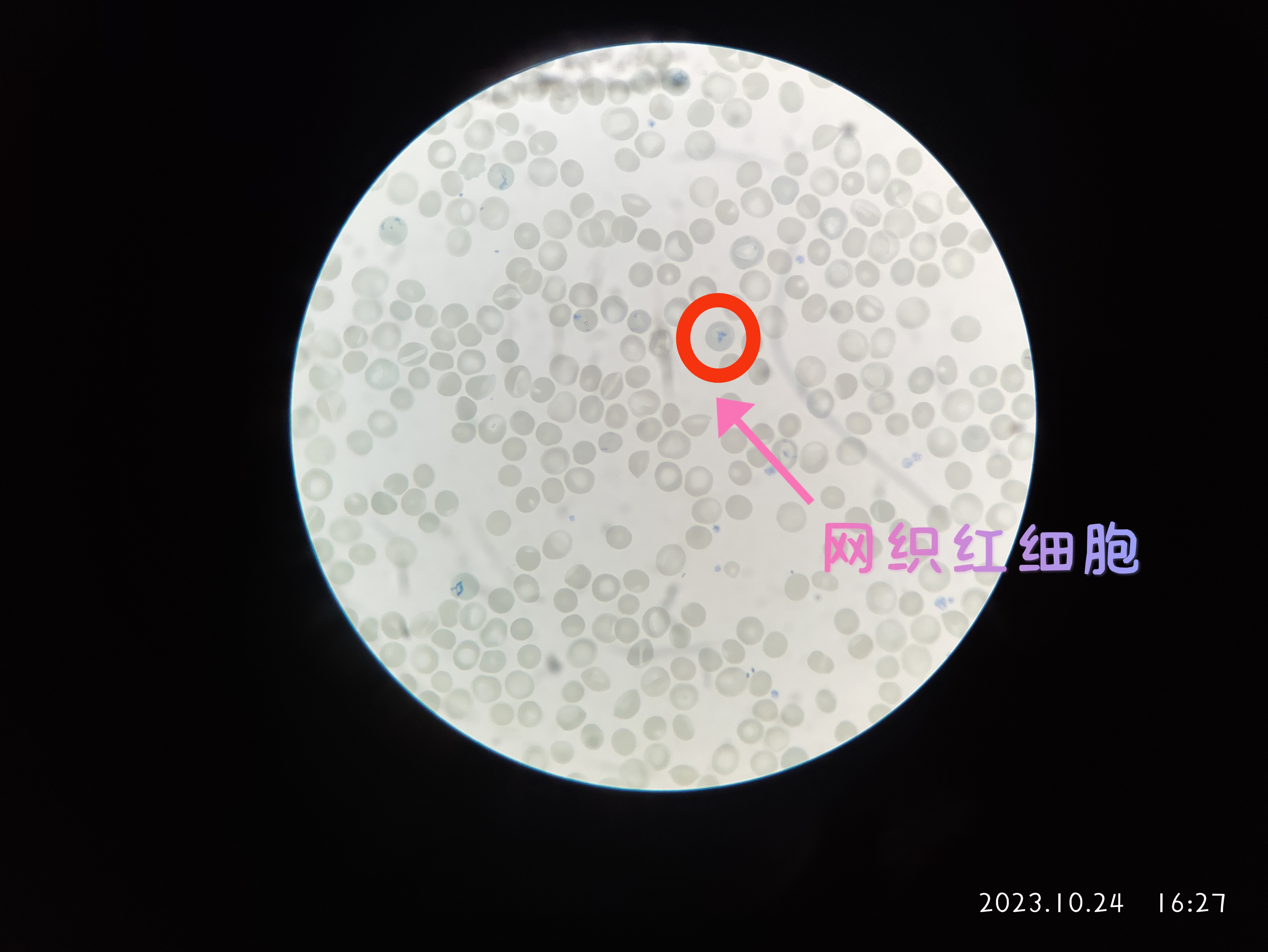 网织红细胞手绘图片