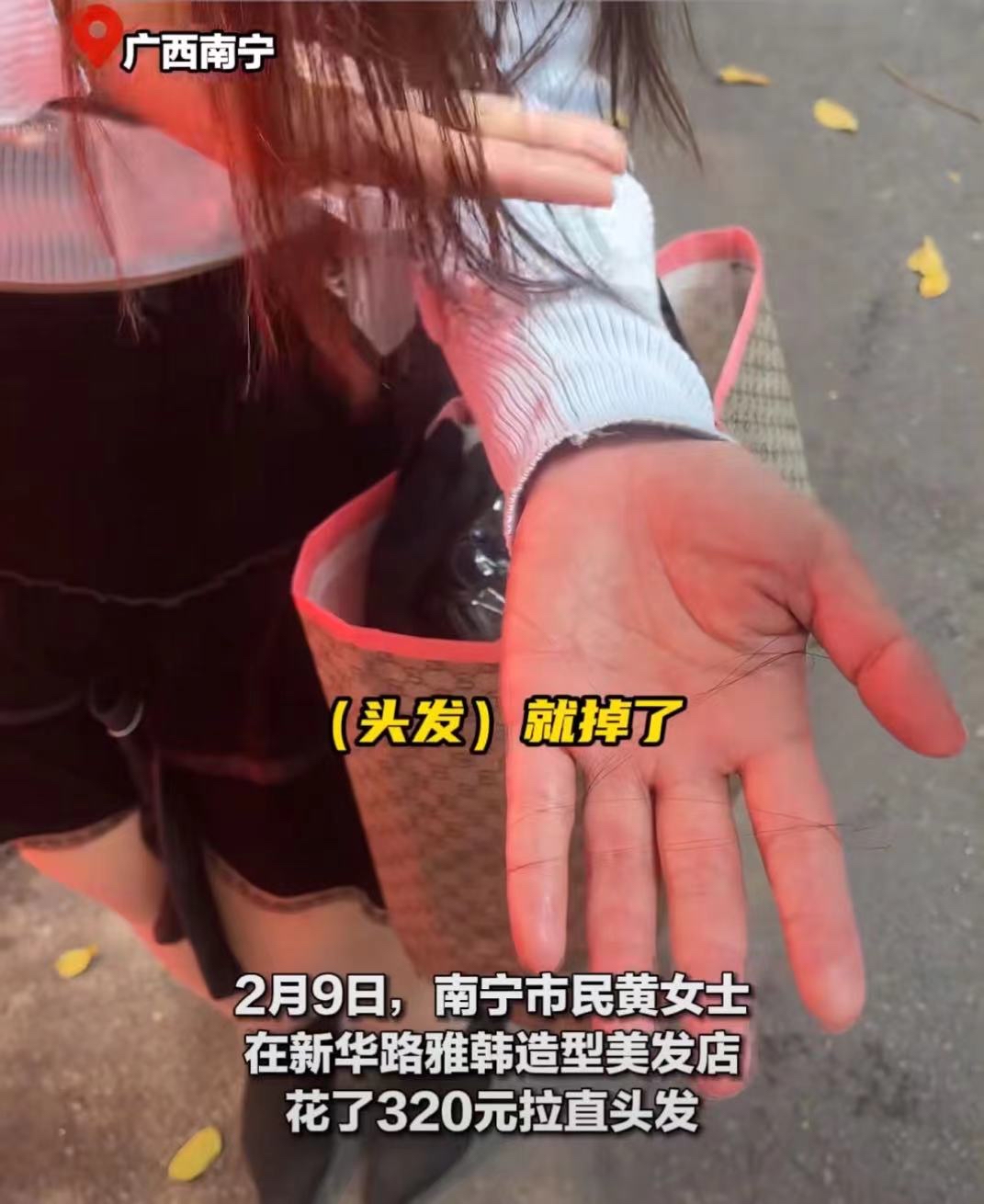 女子在美发店拉直头发,回家后头顶竟然大量脱发!网友:太可怕了!