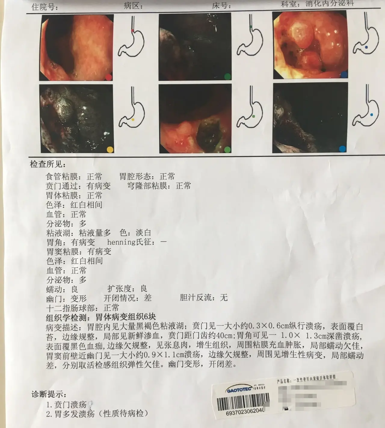 胃癌,结直肠癌化疗一个疗程是多久?