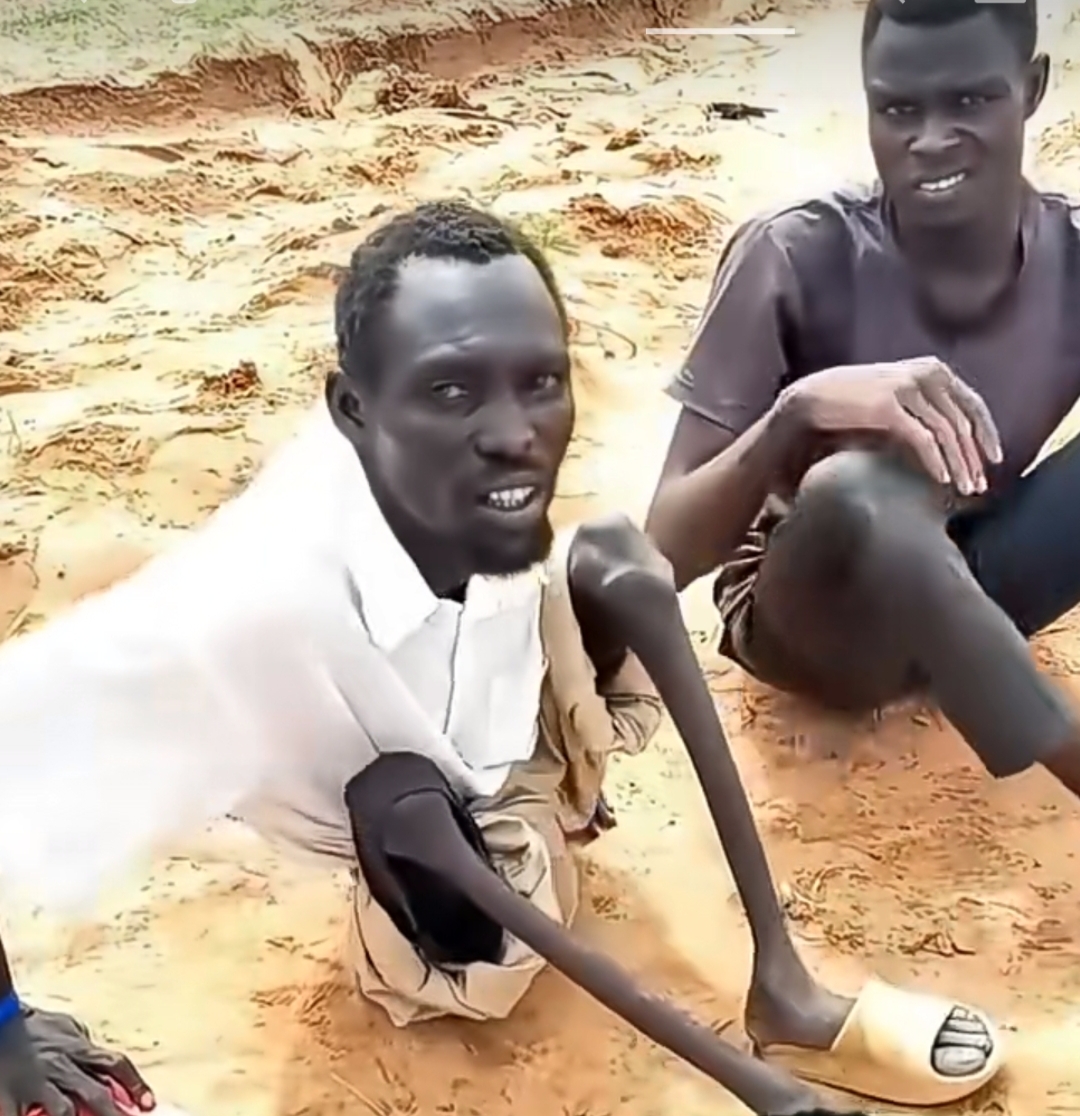 非洲的黑人兄弟诠释了什么是骨肉如材,触目惊心啊这怎么活的啊,是饿成