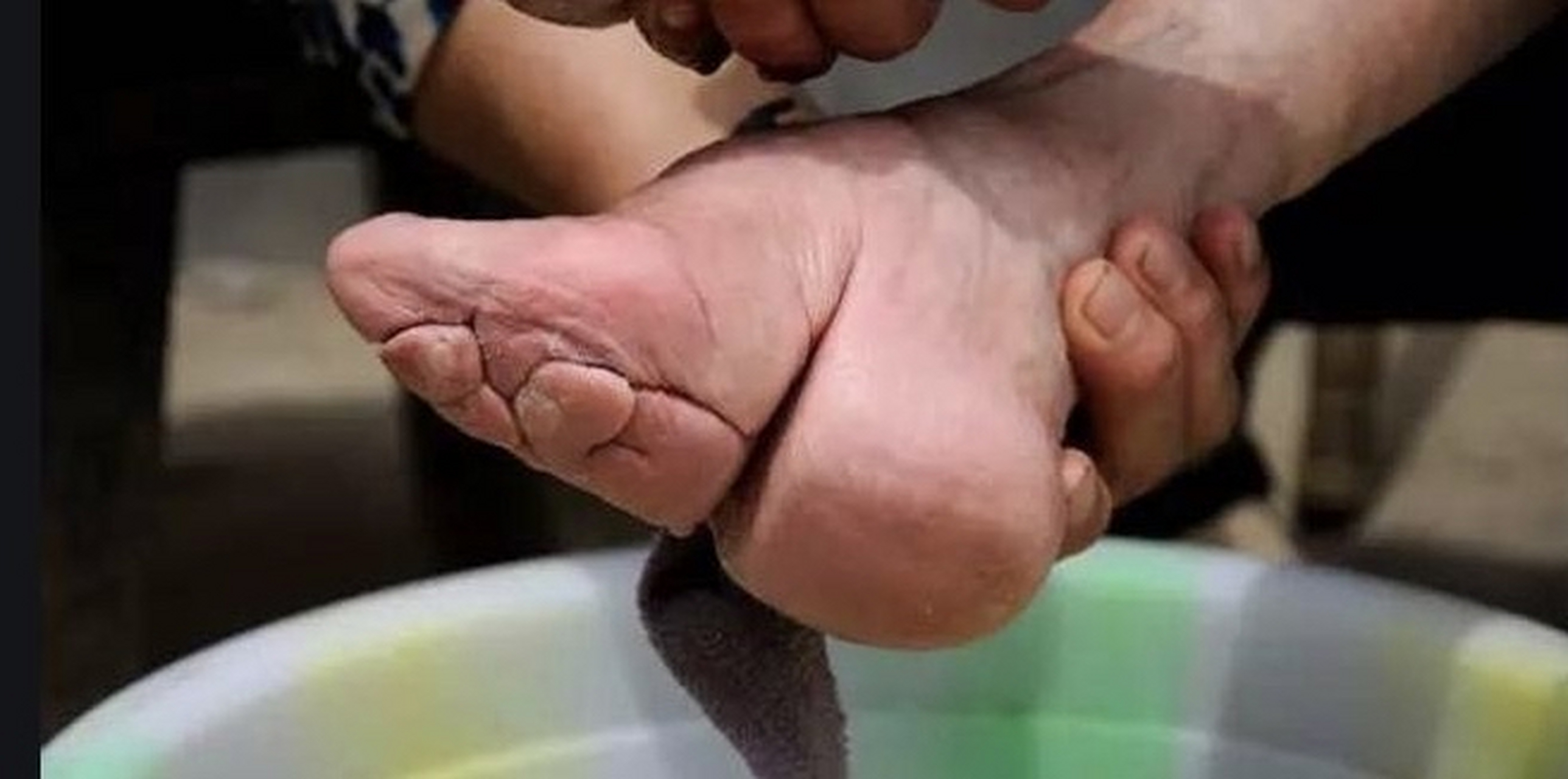 缠足是中国古代一种陋习.是用布将女性双脚紧紧缠裹,使之畸形变小.