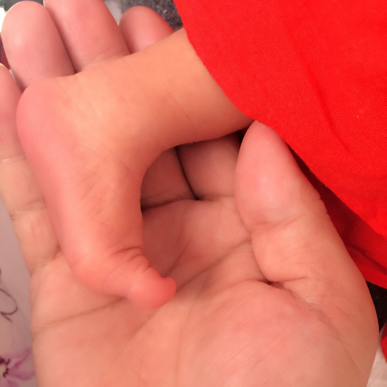 这个脚到底是扁平足还是弓形足,在线等,挺急的!