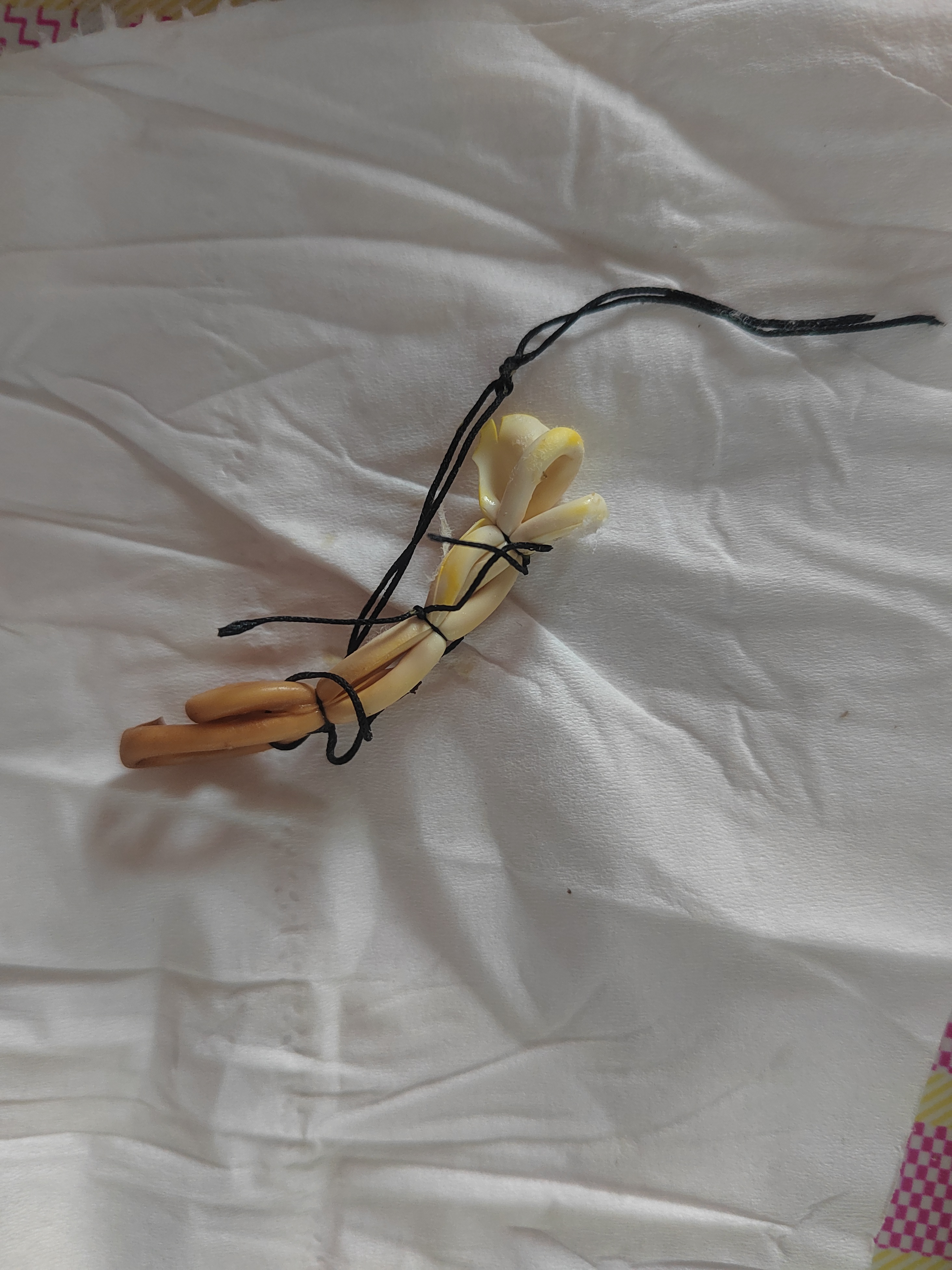 肛瘘手术橡皮筋原理视频肛瘘手术后能吃豆腐吗肛瘘真实图片肛瘘手术