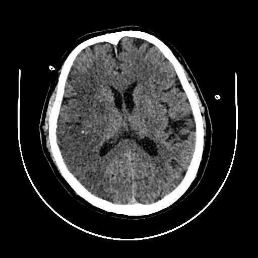 北京胸科医院APP挂号核磁加急-北京胸科医院app挂号核磁加急多少钱 