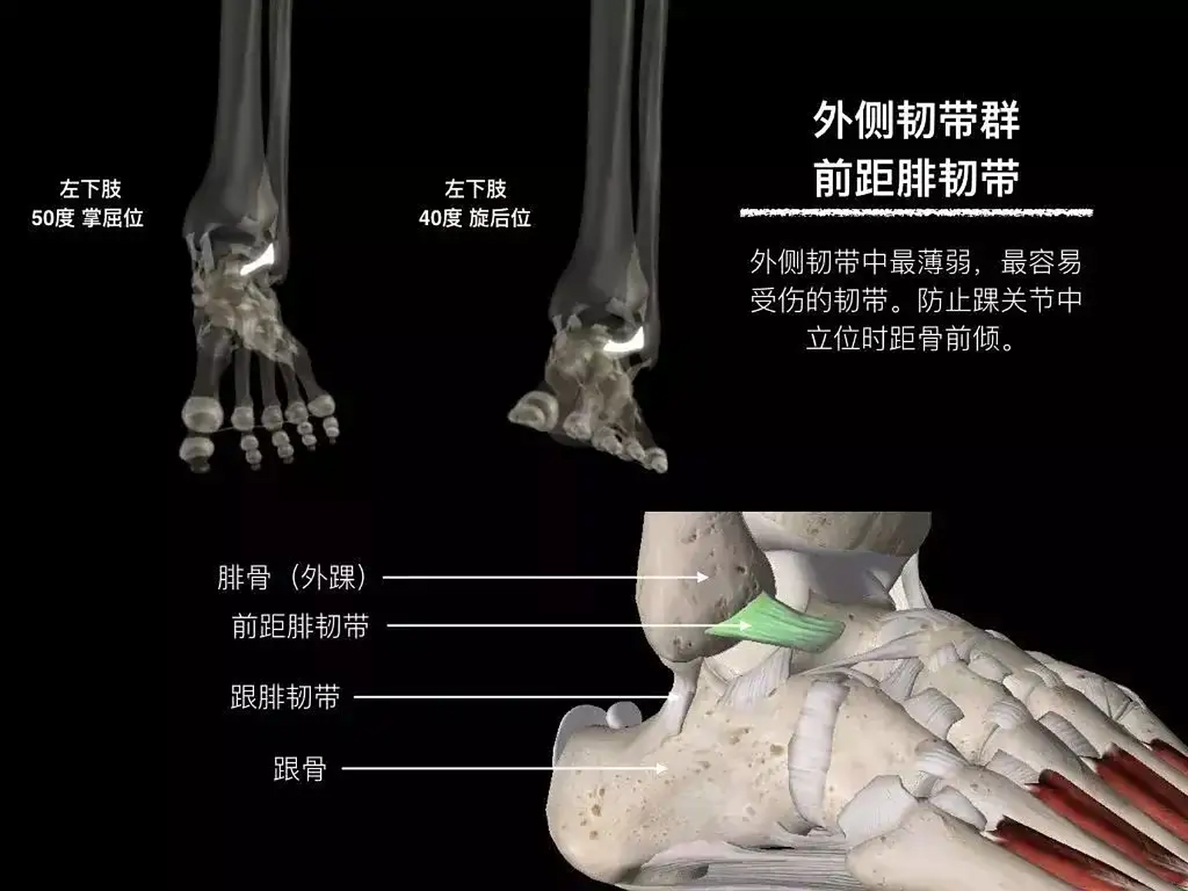 距腓韧带重建术后,多久可以开始内翻练习?