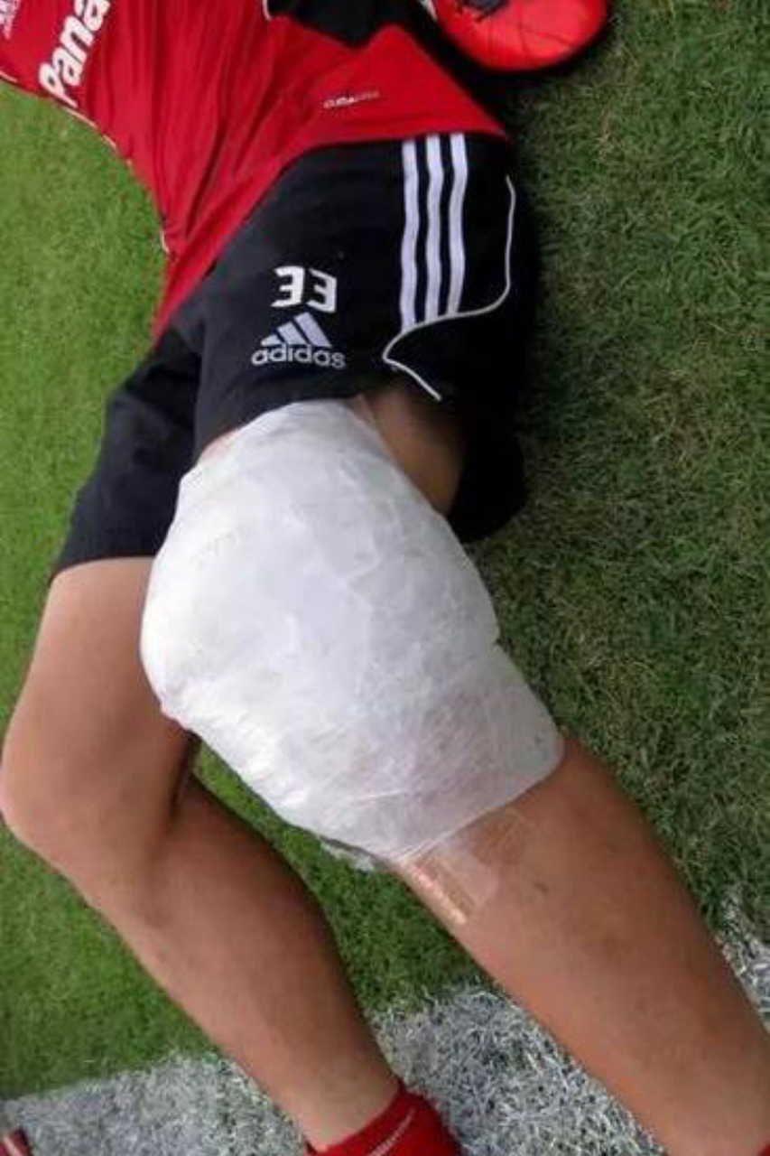 很多人掰腿后都会选择伸直膝盖来冰敷,但其实弯曲状态下冰敷,更有