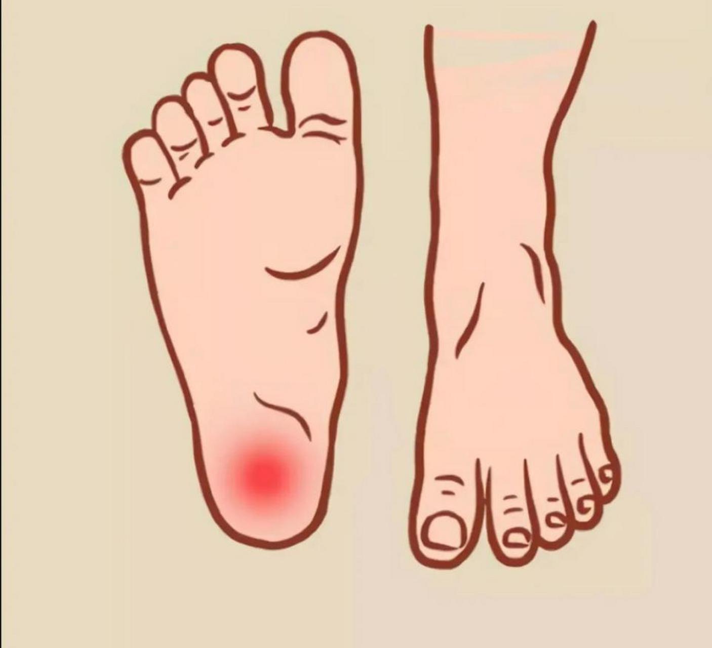 脚后跟疼,是肾虚"捣的鬼 1.