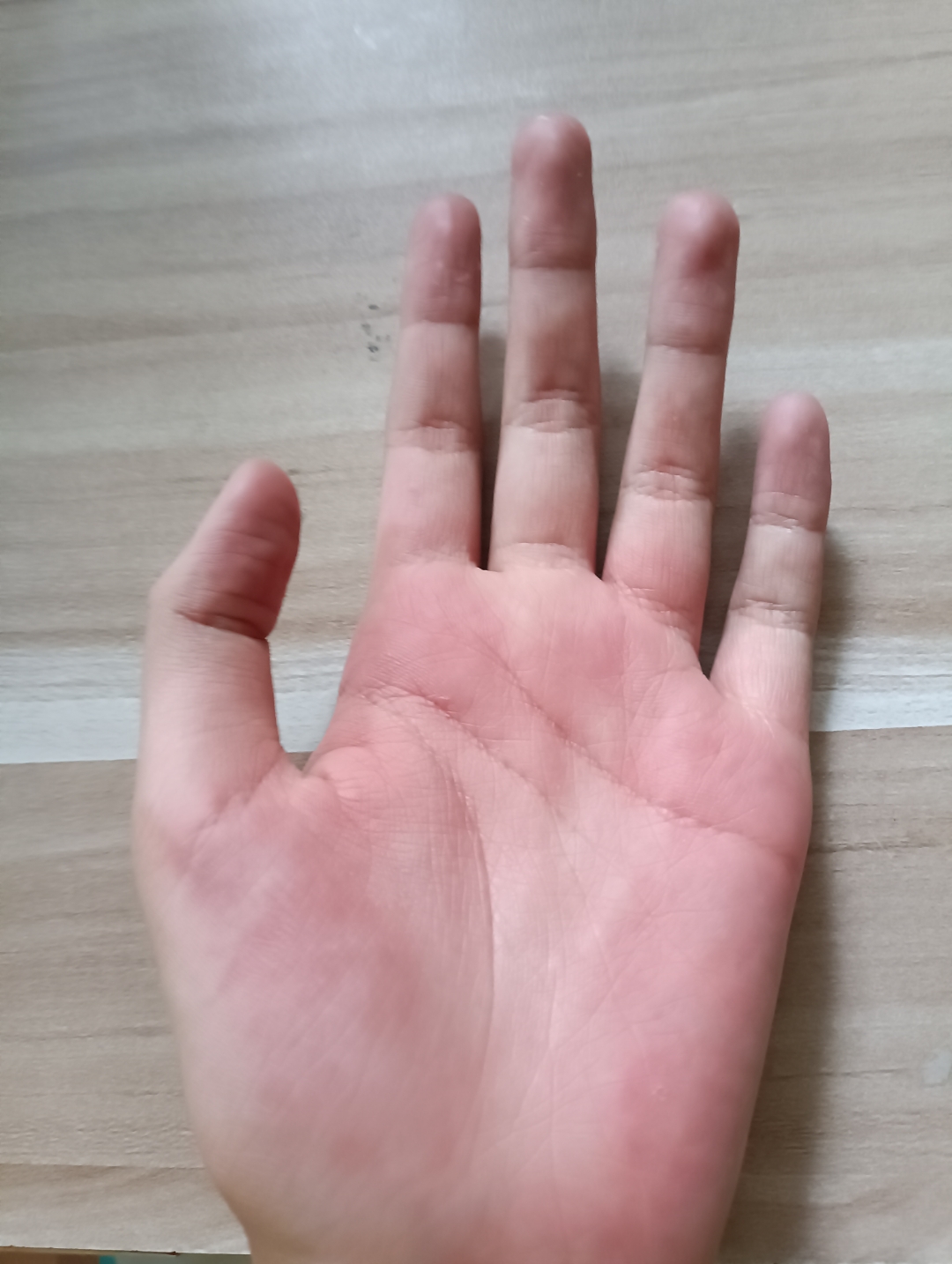 被家长的手板了,呜呜呜呜呜[流泪][流泪][流泪]