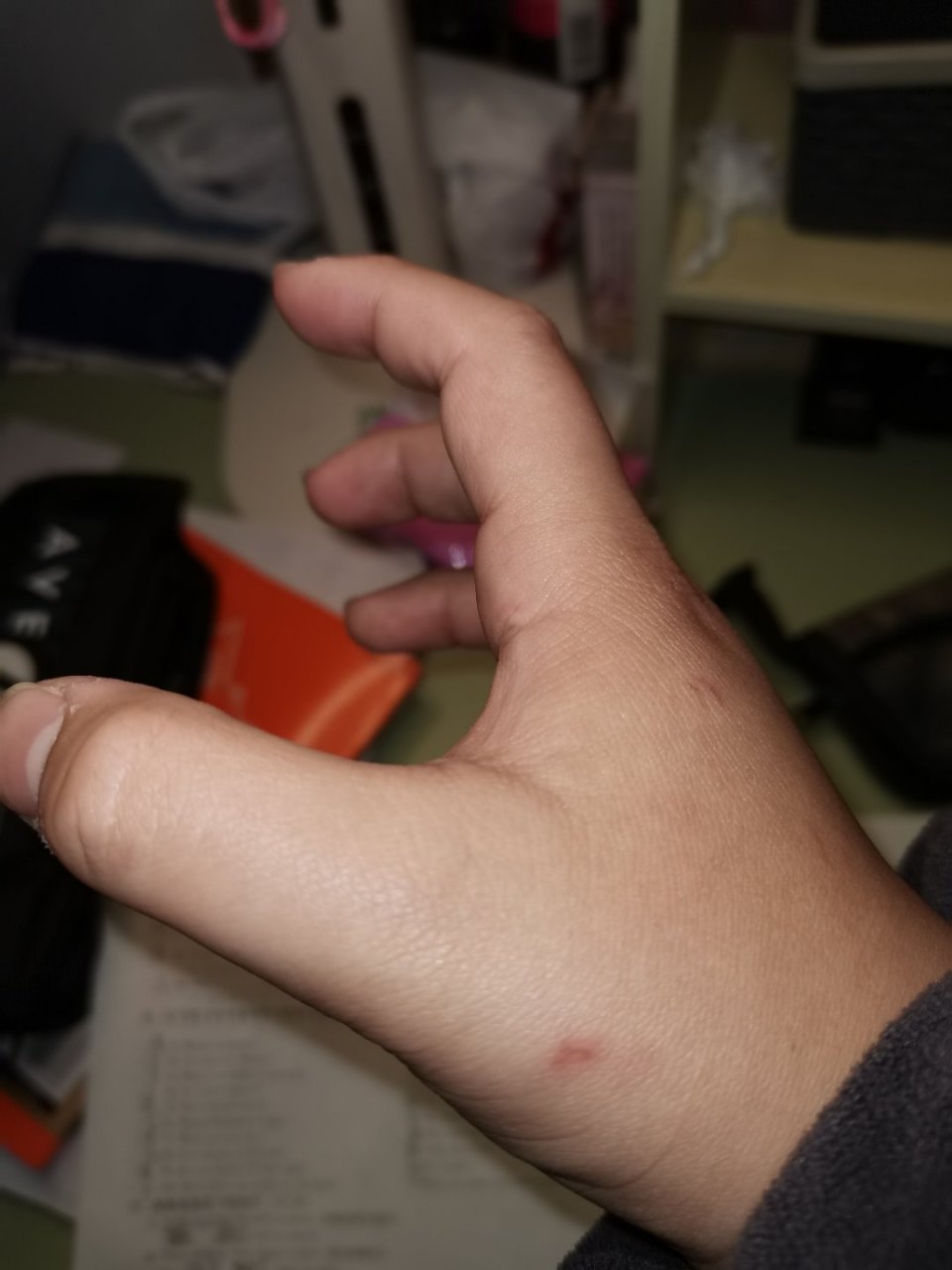 阿尔贝莱特aruvelut 你可当个人吧