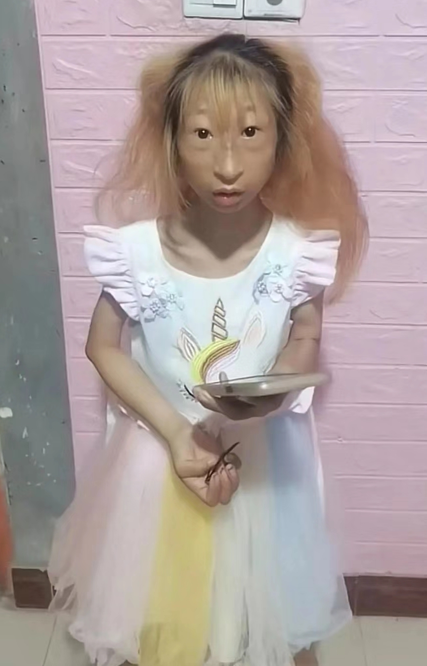 这个小女孩以前有断断续续刷过她的视频,因为生病,长相比较奇特,她也