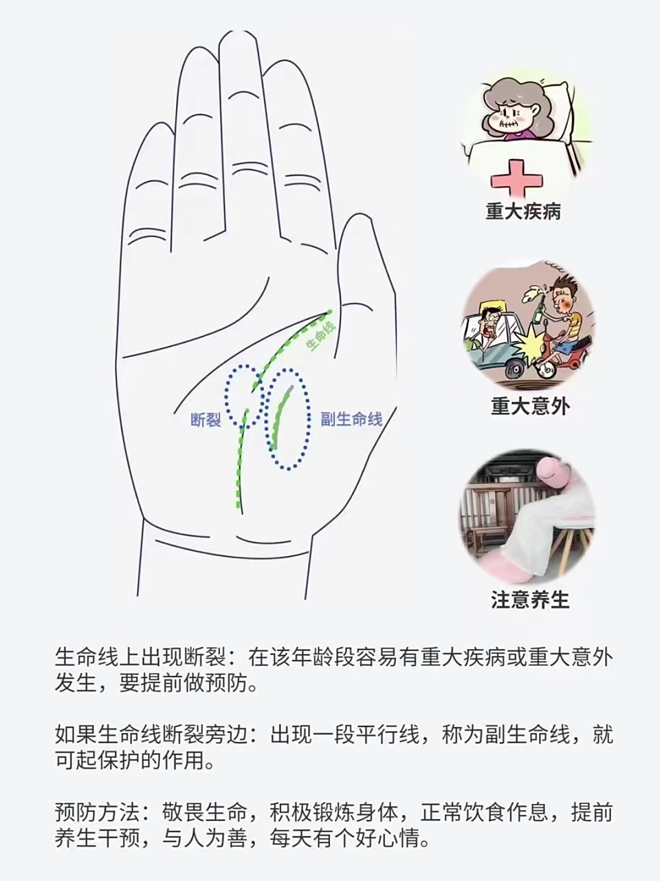 手诊# 95 【手诊基础知识】 生命线中间断裂  生命线上出现断裂:在