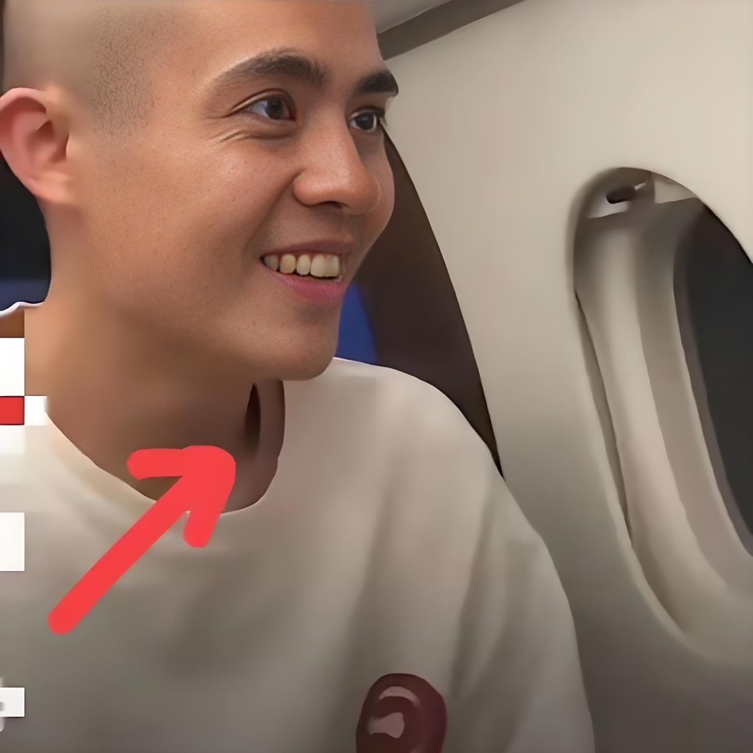 星星脖子上的伤痕像藤蔓一样缠着他,泰国的炎夏热得