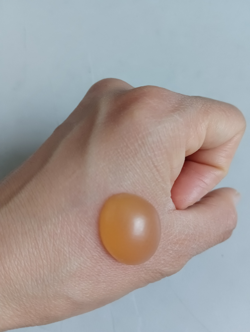 昨天做隔姜灸,灸出一个大水泡,灸完最开始是两个小水泡,慢慢就变这么