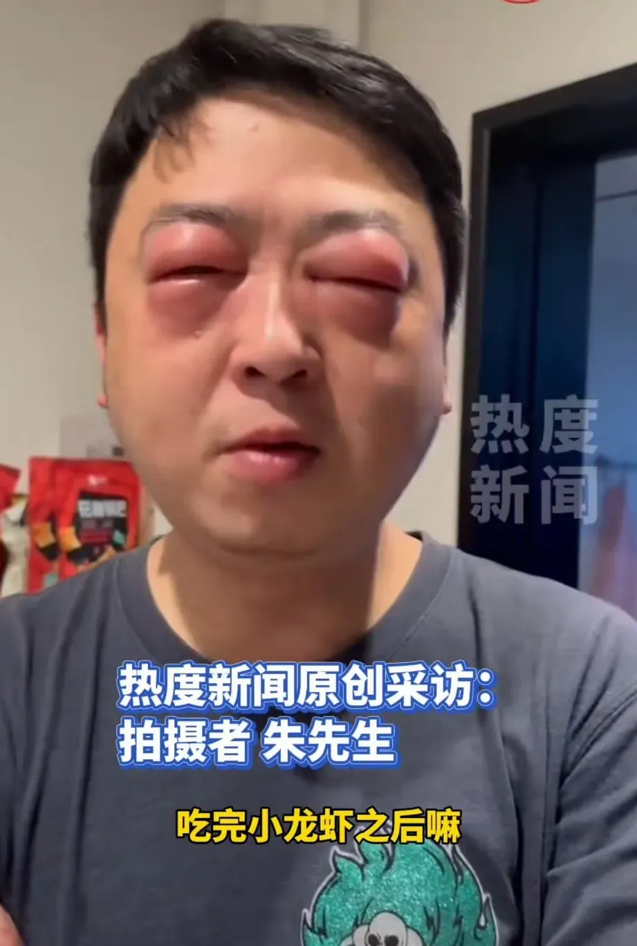 竟然还真有人小龙虾过敏的!你是爱情公寓里的张伟吗?
