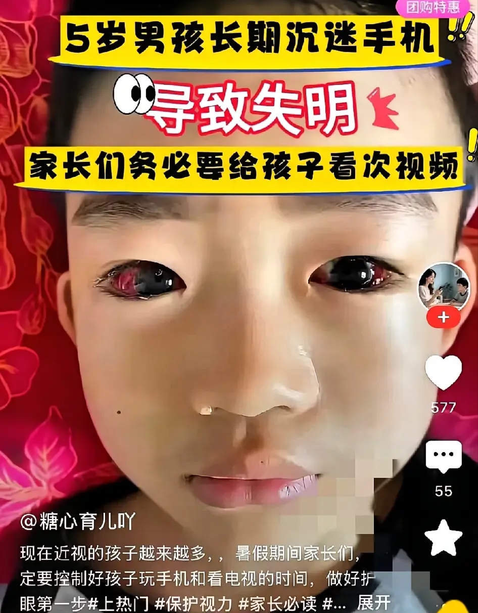 失明了小孩看手机眼睛出血图片你眼瞎了瞎掉的眼睛失明的眼睛是什么